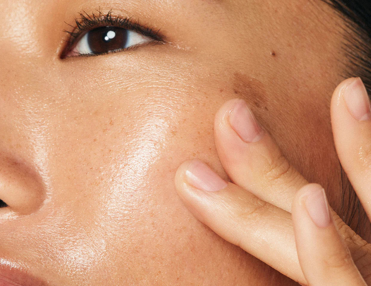 Dark Spots