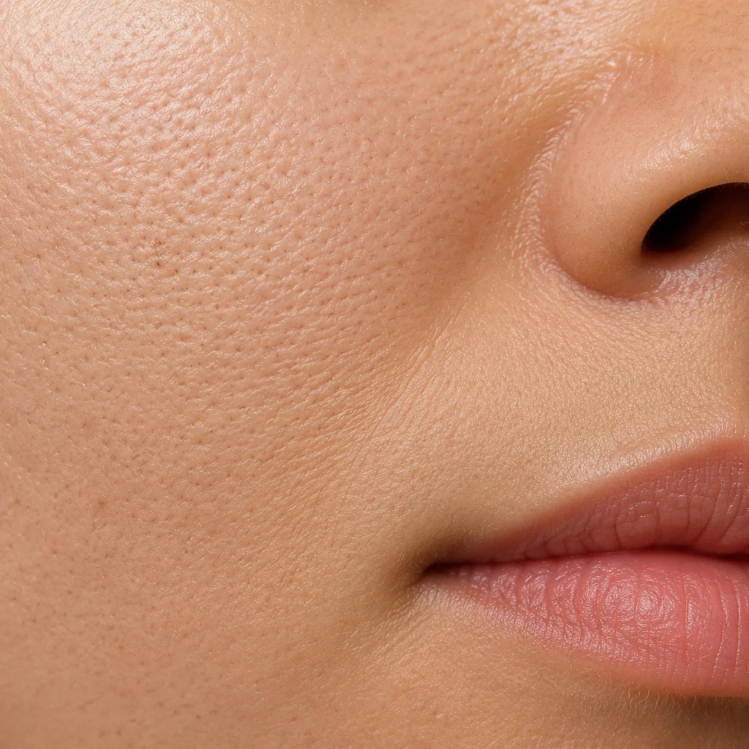 Pores