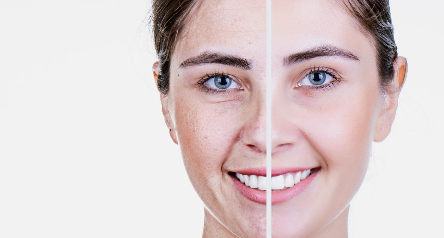 Anti Aging and skin care
